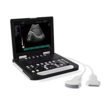 Vollendigitaler Laptop-Ultraschallscanner